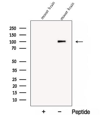 Polyclonal Rabbit anti-Human COPG2 Antibody (WB)