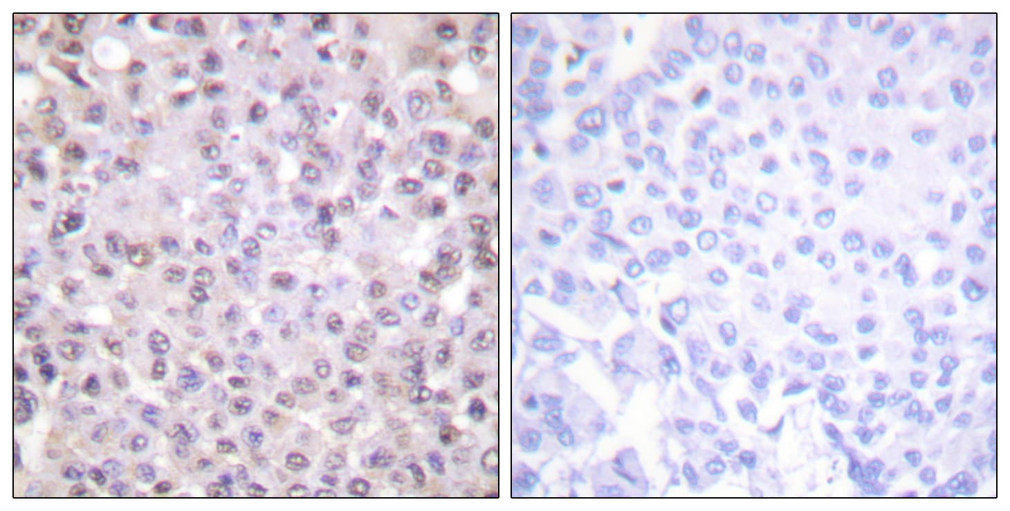 N-CoR / NCOR1 Antibody (aa51-100)