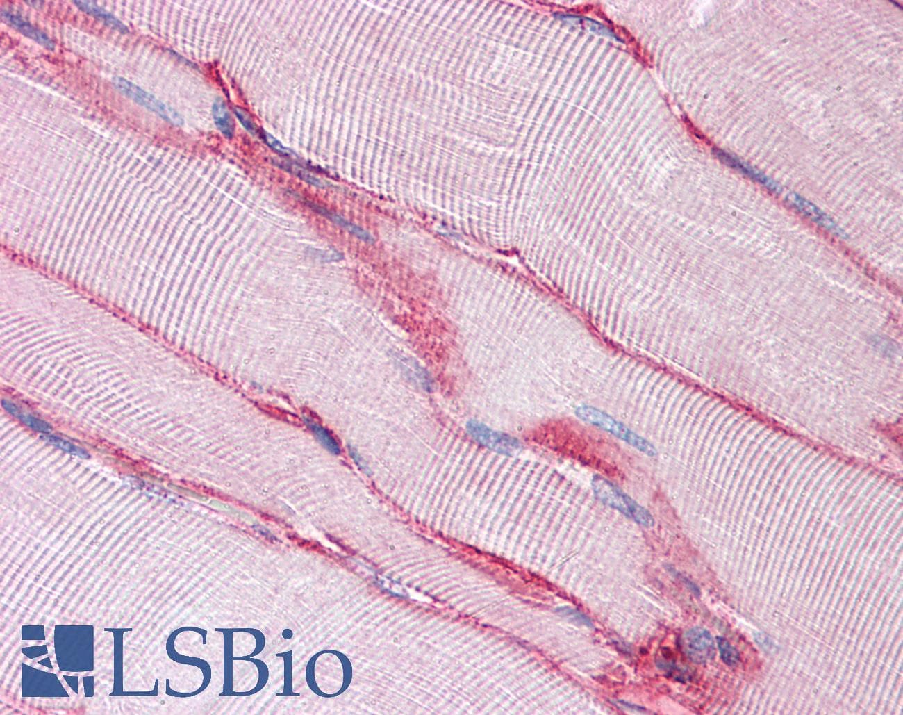 IHC-plus™ Monoclonal Mouse anti-Human SGCB / SGC / Sarcoglycan Beta Antibody (clone 1C10, IHC, IF, WB)