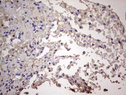 CGB / hCG Beta Antibody (aa21-165, clone OTI12H5)