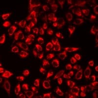 TPH2 Antibody