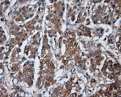 HDAC10 Antibody (clone OTI8G5)