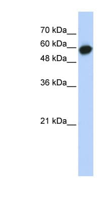 Polyclonal Rabbit anti-Human LRRC6 Antibody (aa395-444, WB)