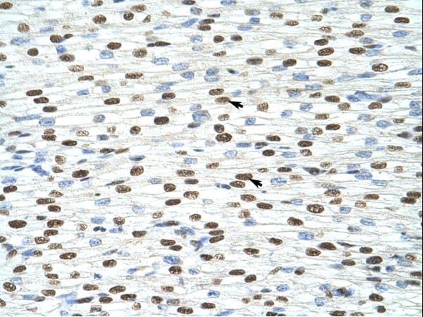 EXOSC4 / RRP41 Antibody (N-Terminus)