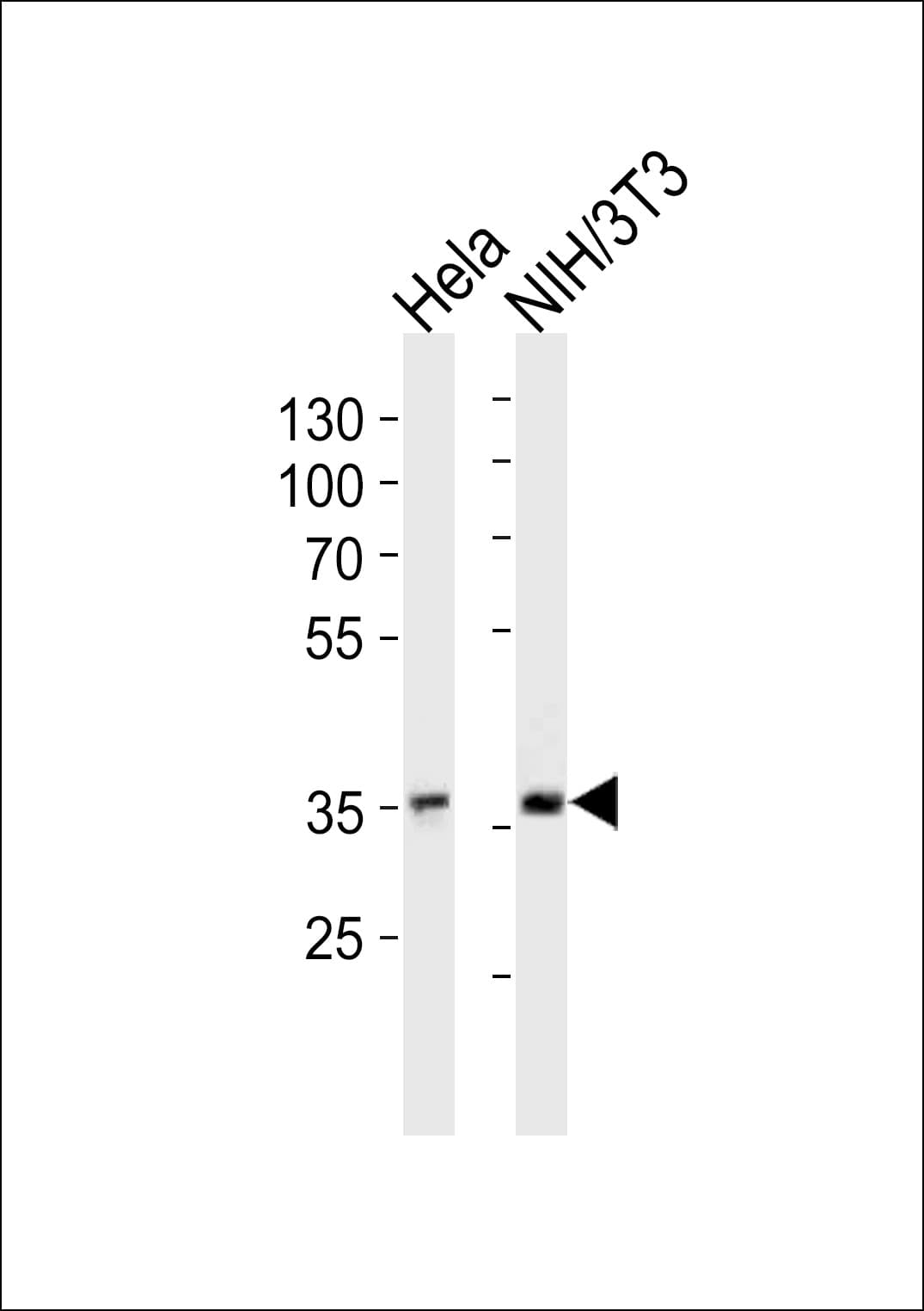 NFKBIA / IKB Alpha / IKBA Antibody (clone 1121CT8.6.1)