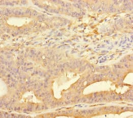 PPFIA1 / LIPRIN Antibody