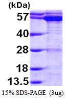 Human TCP1 Protein (Recombinant His)
