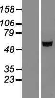 IGSF21 Protein (Over-Expression Lysate Myc-DDK (Flag))