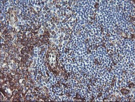 Monoclonal Mouse anti-Human TMEM173 / STING Antibody (clone 1A7, Carrier-free, IHC, WB)