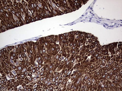 Monoclonal Mouse anti-Human KRT19 / CK19 / Cytokeratin 19 Antibody (clone OTI5H6, aa240-390, IHC, WB)