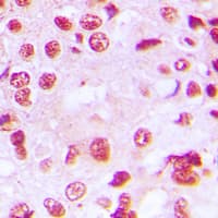 RORA / ROR Alpha Antibody (N-Terminus)