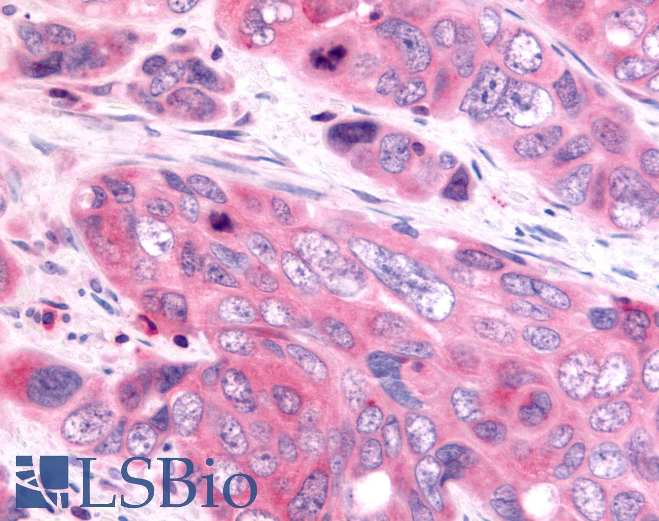 PathPlus™ Polyclonal Rabbit anti-Human HUNK / B19 Antibody (Internal, IHC)