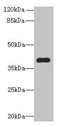 PNMA1 / MA1 Antibody