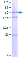 Human FAM164A / CGI-62 Protein (Recombinant GST)