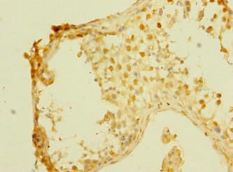 PALS2 / MPP6 Antibody