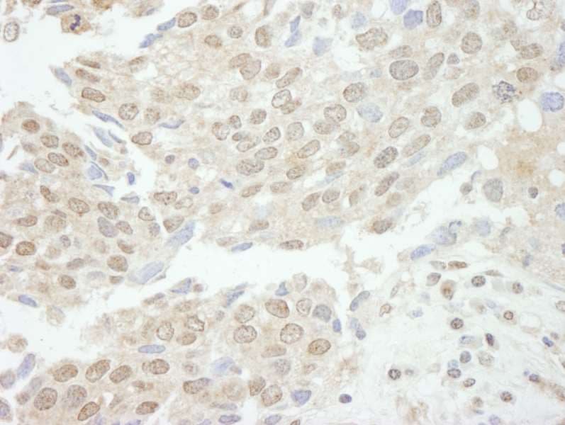 TDP1 Antibody (aa1-50)