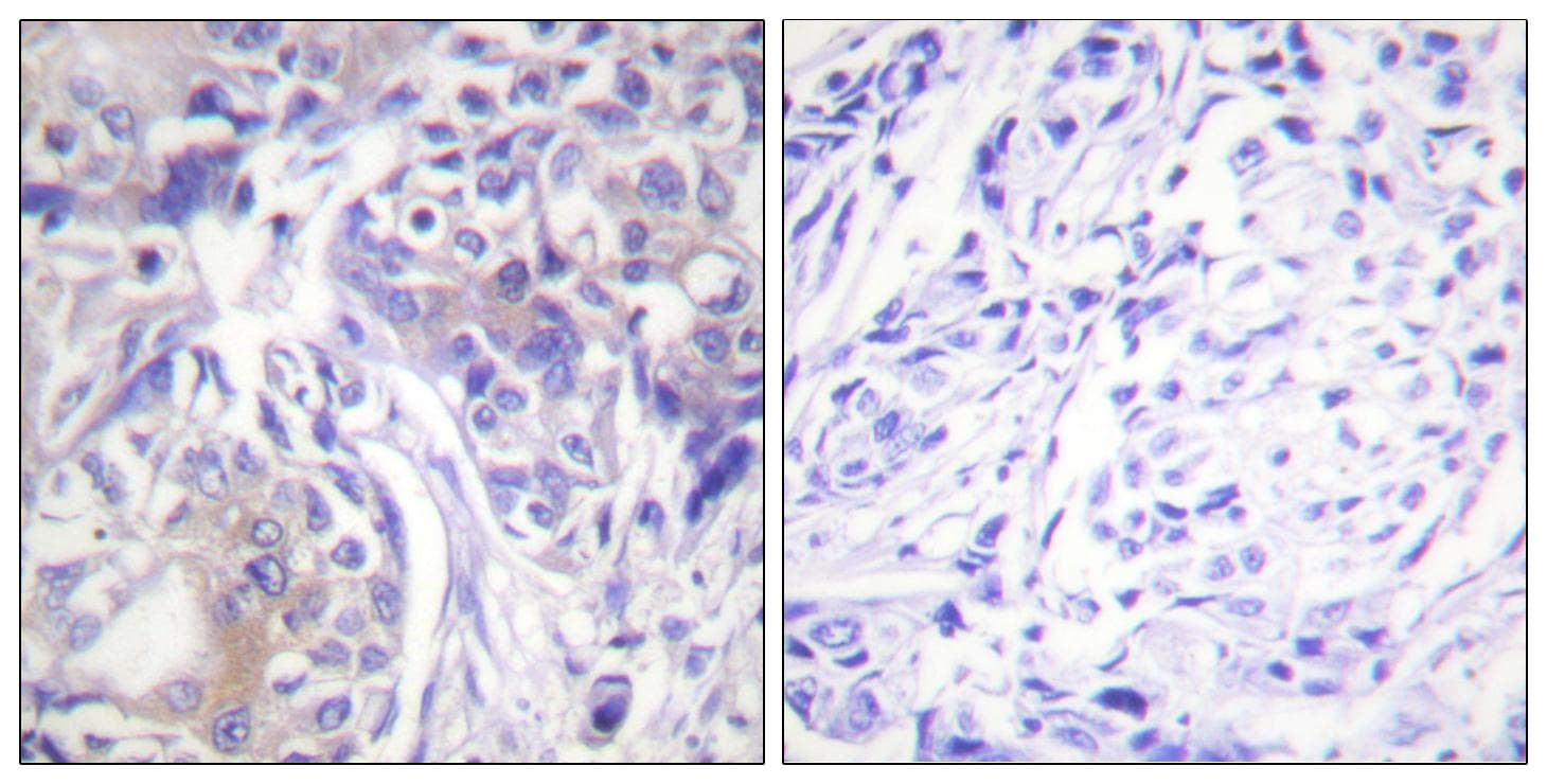 Polyclonal Rabbit anti-Human ADD1 / Adducin Alpha Antibody (IHC, IF)