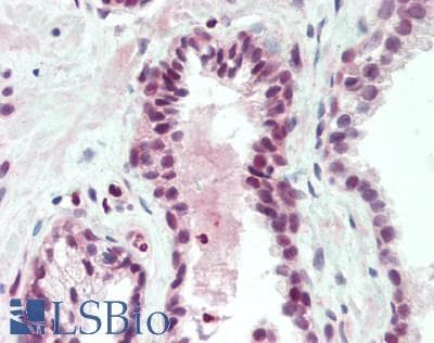 IHC-plus™ NACC1 / NAC1 Antibody (aa324-358)