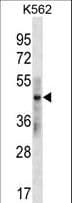 KRT33B / Keratin 33B / KRTHA3B Antibody (aa64-91)