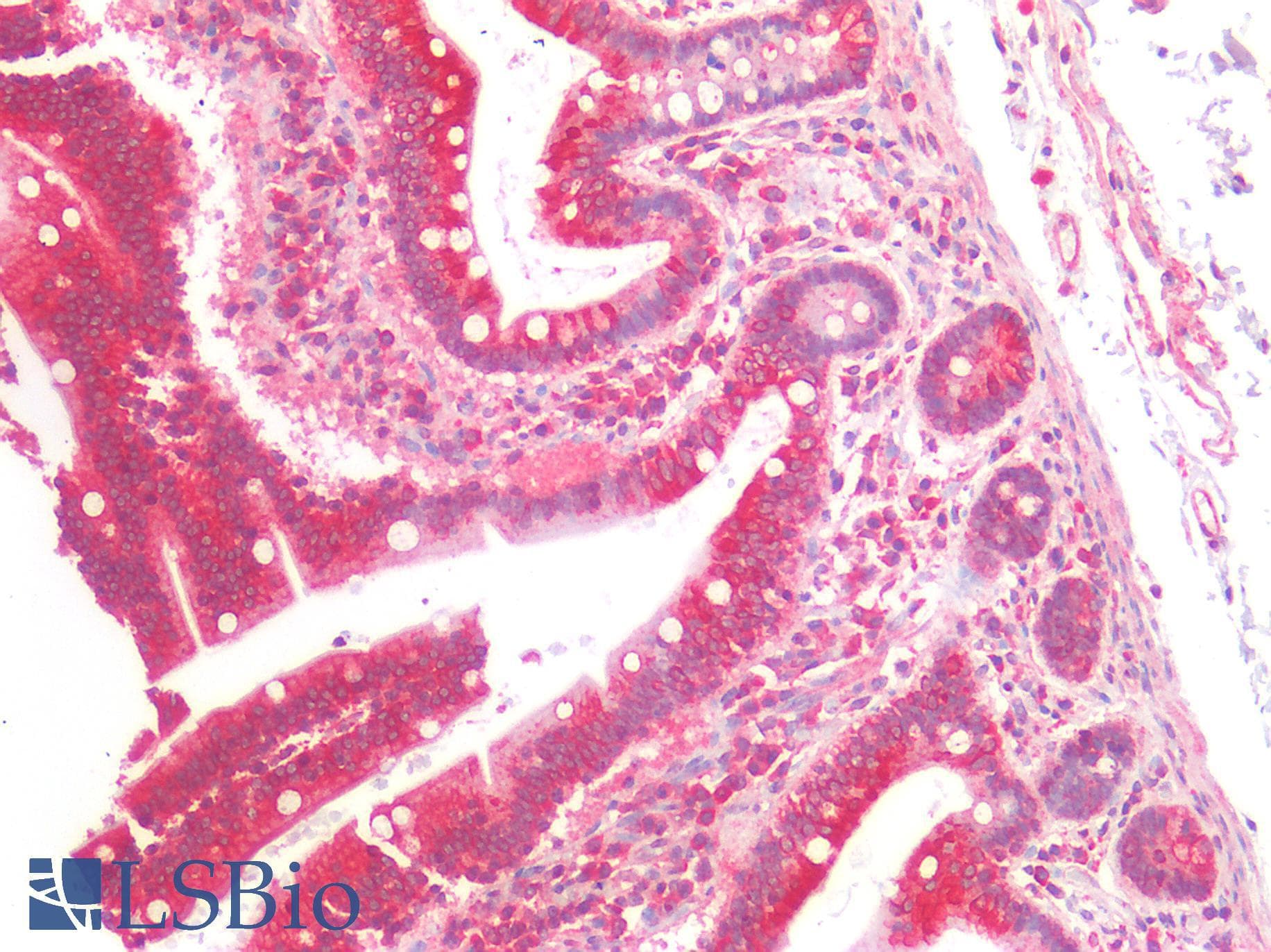 IHC-plus™ TP53 / p53 Antibody