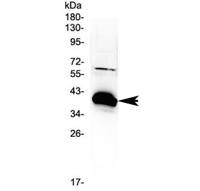 BAG1 / BAG-1 Antibody