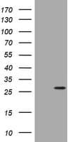 BNIP1 Antibody (aa1-199, clone OTI1H3)