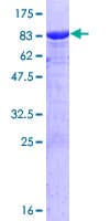 Human CTNNA1 / Catenin Alpha-1 Protein (Recombinant GST)