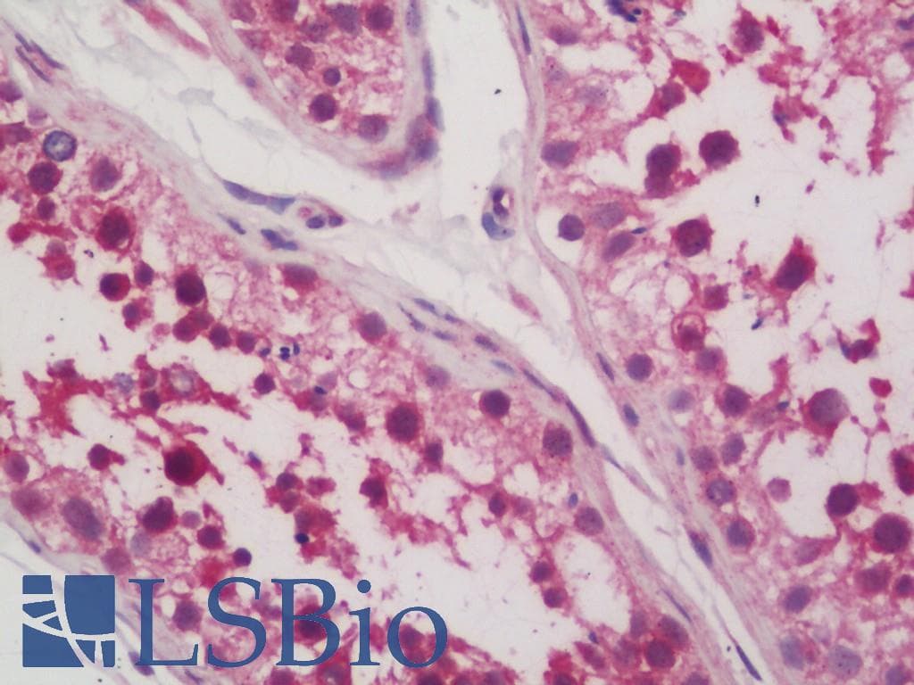 IHC-plus™ Dipeptidylpeptidase 8 / DPP8 Antibody (aa349-662)