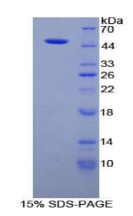 Human FBN1 / Fibrillin 1 Protein (Recombinant His-GST)