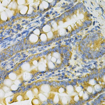 Polyclonal Rabbit anti-Human PGK1 / Phosphoglycerate Kinase Antibody (IHC, WB)