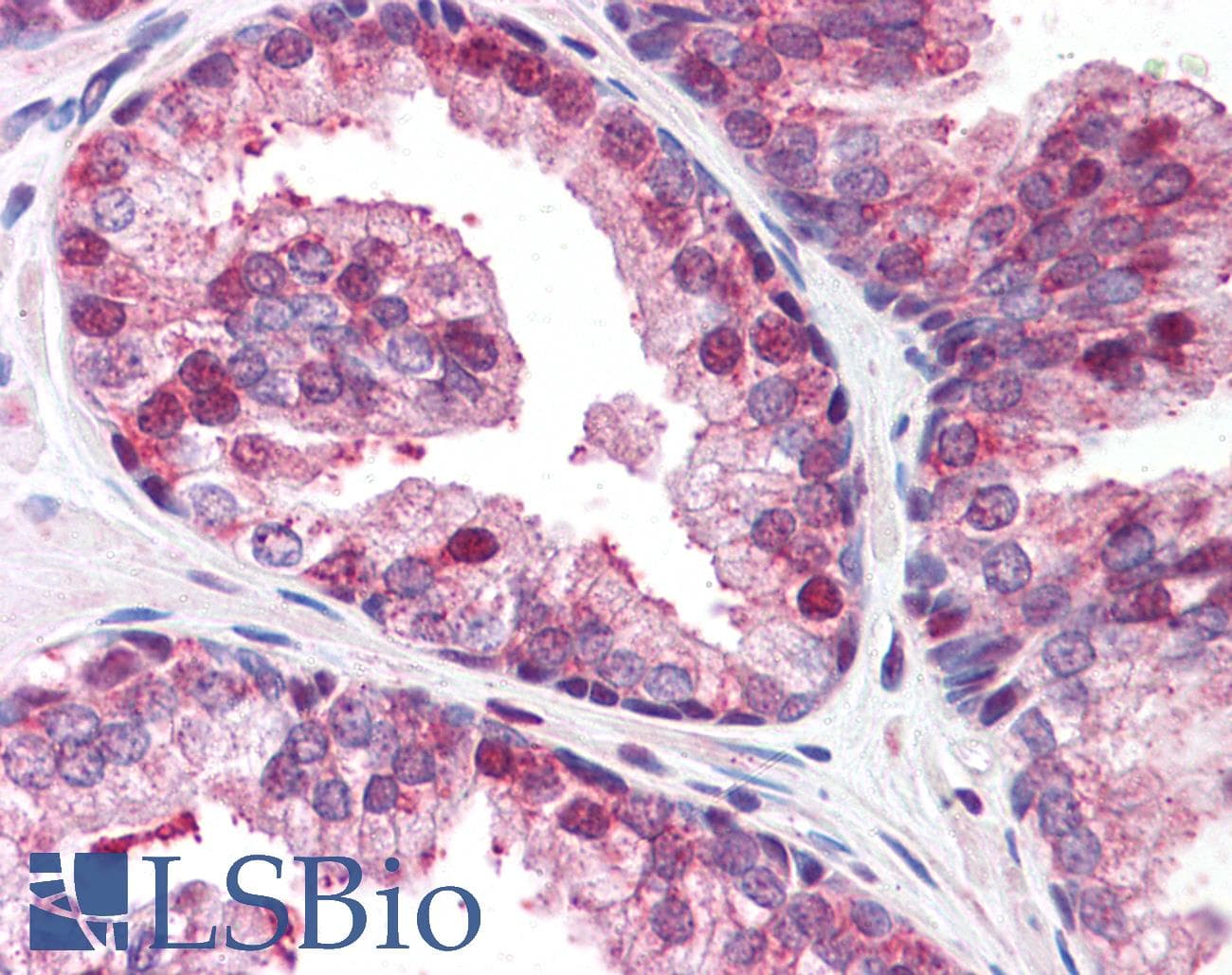 IHC-plus™ GOLPH3 Antibody