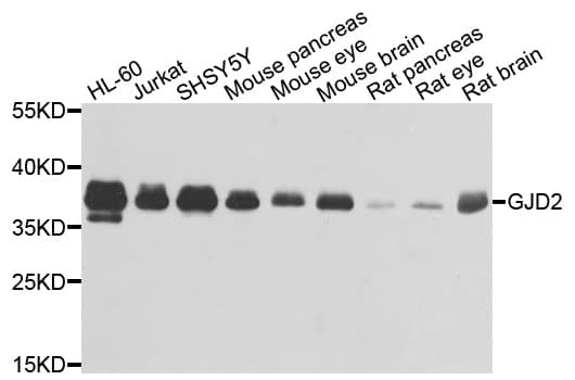 Polyclonal Rabbit anti-Human GJD2 / CX36 / Connexin 36 Antibody (WB)