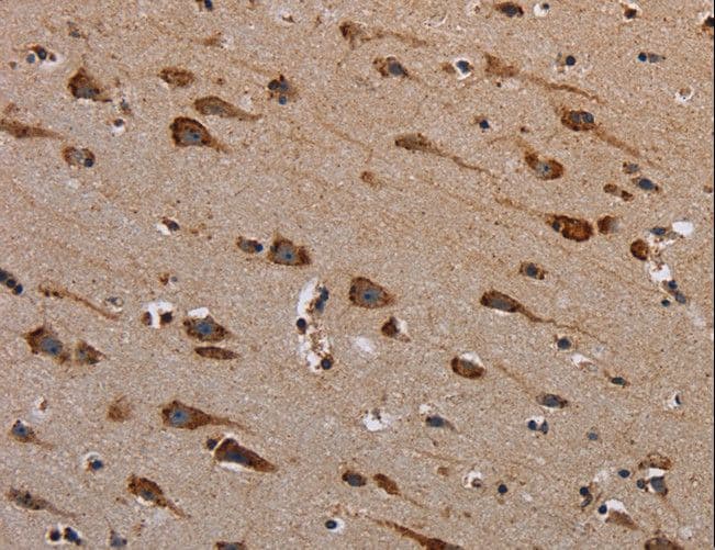 PLXNB1 / Plexin-B1 Antibody
