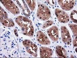 SULT1C2 / Sulfotransferase 1C2 Antibody (clone OTI4G1)