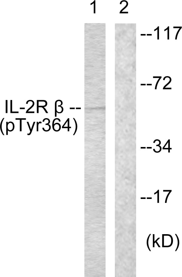 Polyclonal Rabbit anti-Human IL2RB / CD122 Antibody (phospho-Tyr364, WB)