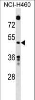 GDA / Nedasin Antibody (aa164-193)