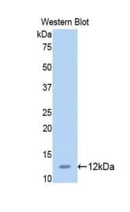 Mucin 2 / MUC2 Antibody (aa27-110)