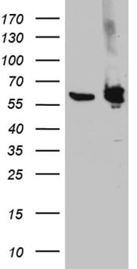 IHC-plus™ Monoclonal Mouse anti-Human PTBP3 / ROD1 Antibody (clone OTI5C9, aa300-552, IHC, WB)