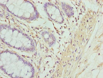 ACTG2 Antibody