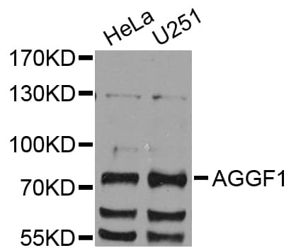 VG5Q / AGGF1 Antibody