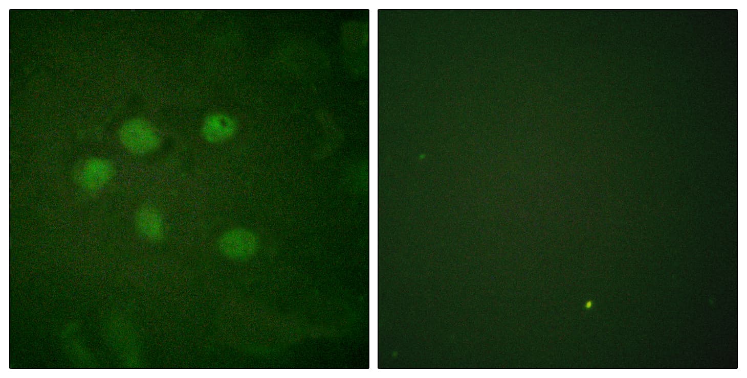 SAE1 Antibody (aa221-270)