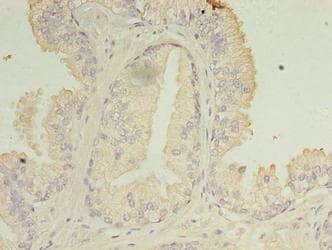Polyclonal Rabbit anti-Human C11orf45 Antibody (IHC)