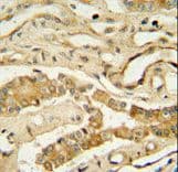 Polyclonal Rabbit anti-Human NDUFAF3 Antibody (aa12-40, IHC, WB)