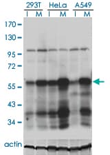 Monoclonal Mouse anti-Human PLK1 / PLK-1 Antibody (clone 2G12, IF, WB)
