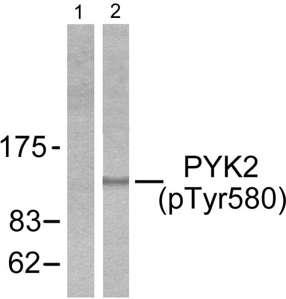 PTK2B / PYK2 Antibody (phospho-Tyr580)