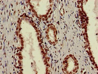 XRCC6 / Ku70 Antibody