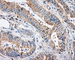 ARHGDIA / RHOGDI Antibody (clone OTI1A7)