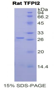 Rat TFPI2 Protein (Recombinant His)