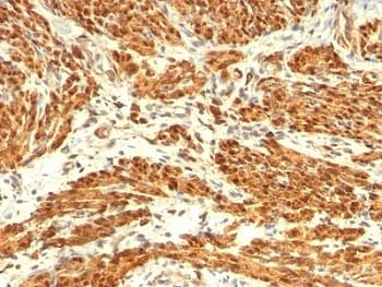 CNN1 / Calponin Antibody (clone CNN1/832 + CALP)