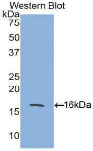 ACVR2 / ACVR2A Antibody (aa20-135, Biotin)